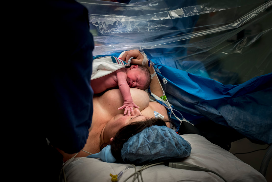 belly birth cesarean section cs